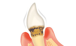 流山市西平井・すずらん歯科クリニック