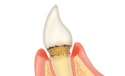 流山市西平井・すずらん歯科クリニック